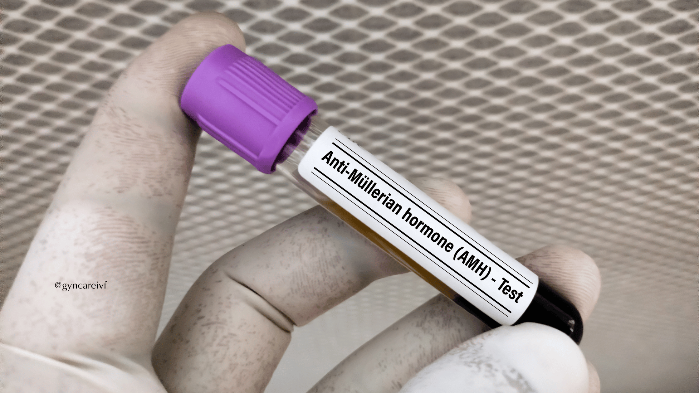 χαμηλή-ΑΜΗ-gyn-care-ivf-10-τροποι-να-βελτιώσετε-το-ωοθηκικό-σας-απόθεμα